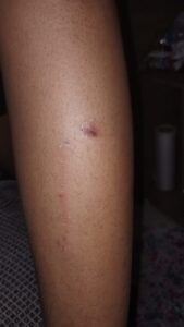 ARCO-IRIS-AGRESSAO-169x300 Violência na EE Auda Malta em Arco-Íris vai parar na polícia